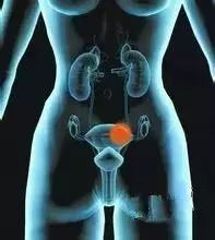 ??子宫肌瘤、乳腺癌原来是这么回事!看完我目瞪口呆!图1