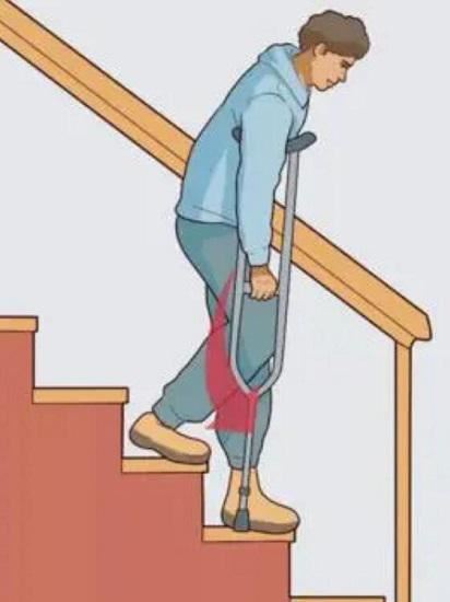 上下楼梯步态训练