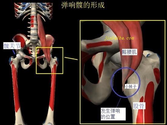 大腿内侧隐隐作痛？可能是&ldquo;弹响髋&rdquo;惹的祸(李晟张睿结婚图1