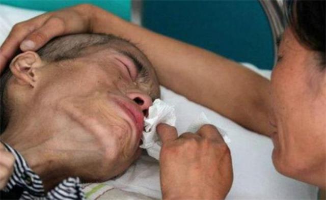 ?为什么全国每年新发恶性肿瘤40%在农村？